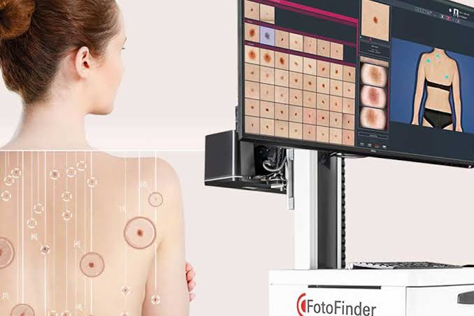 FotoFinder total-body mole mapping system